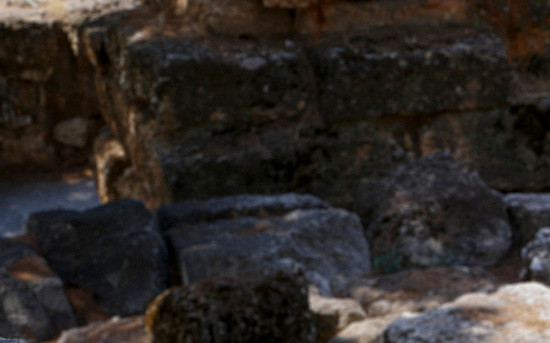 Как эмоции и стресс провоцируют психосоматику? Рубрика: Психологи не дают советов